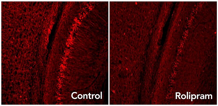 Migliorare lo smaltimento dei rifiuti del cervello può rallentare l'Alzheimer, perlomeno nei topi