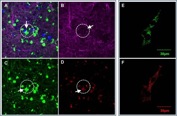 2020 EBIOMED paper MR2