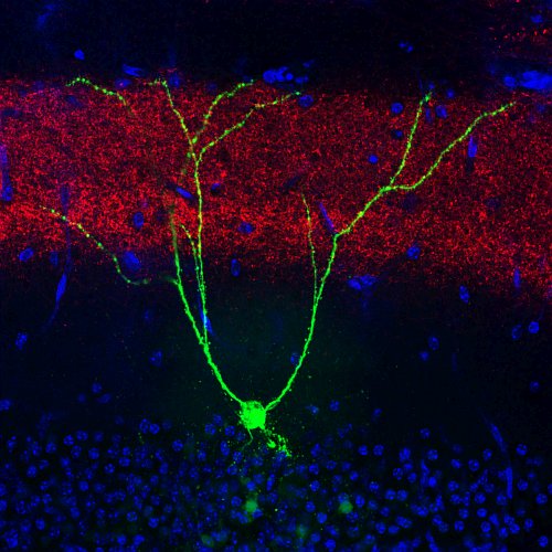 L'Alzheimer impedisce di formare i ricordi o solo di recuperarli?