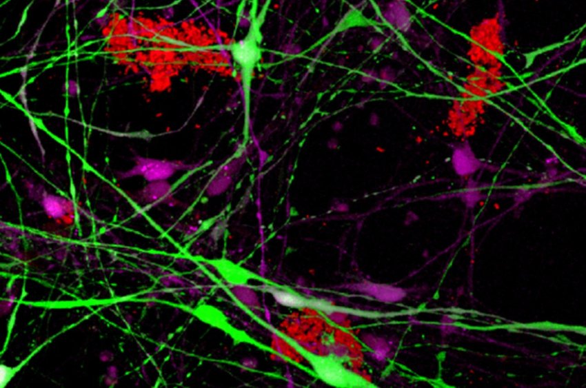 3D model of human neurons in a plate