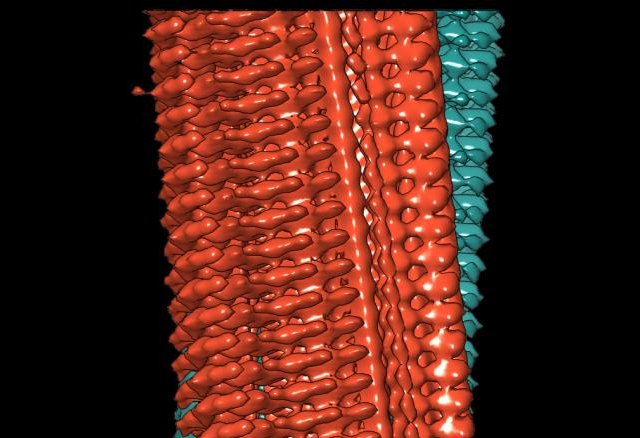 L'immagine più nitida delle fibrille di AD mostra dettagli finora ignoti