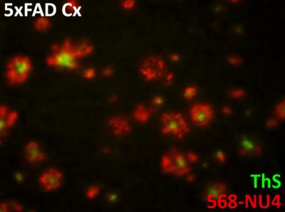 Nuovo metodo non invasivo individua l'Alzheimer precocemente