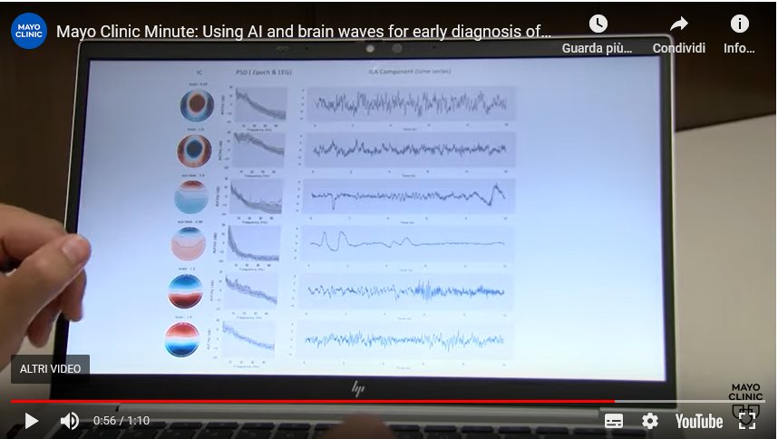 AI and brain waves for AD diagnosis