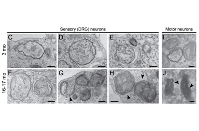 Aberrantly formed autophagosomes accumulate in neuron of an aged mouse