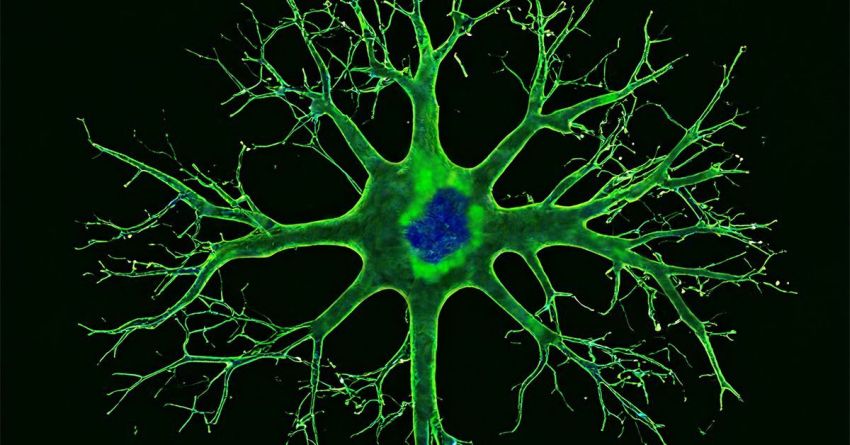 Aged neuron stained for stress by UCSD