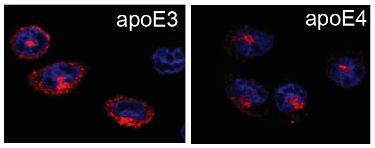 ApoE3 and ApoE4