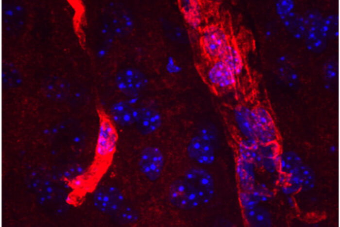 Aquaporin around blood vessels