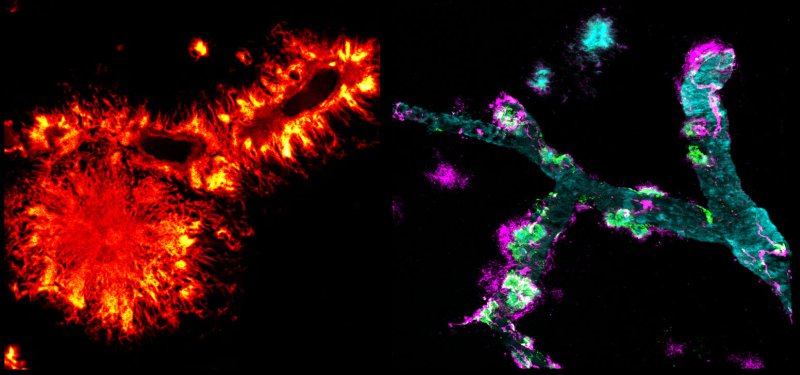 Blood vessels and amyloids