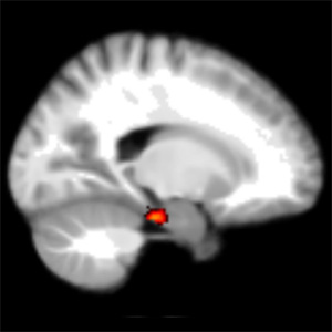 Spiegato perchè alcune persone sono navigatori migliori, e perchè i pazienti di Alzheimer si perdono 