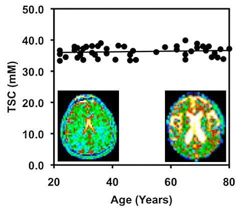 Con l'età i neuroni diventano più piccoli, ma restano lo stesso numero