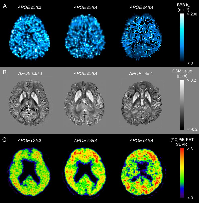 Brain Blood barrier Kw map