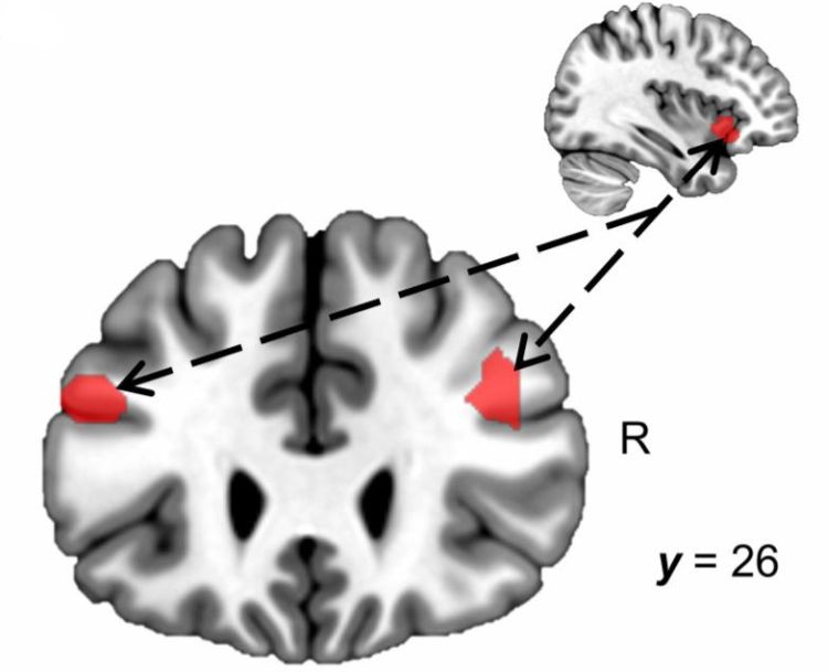 Brain cognitive fatigue by Vikrma Chib JHopkins