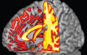 E' nel sangue? Trovato collegamento tra gruppo sanguigno e rischio di declino cognitivo