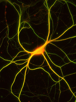 Proteine immunitarie, come secondo lavoro, regolano le connessioni tra le cellule del cervello