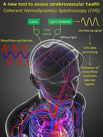 Un nuovo modo di diagnosticare danni cerebrali da commozione, ictus e demenza 