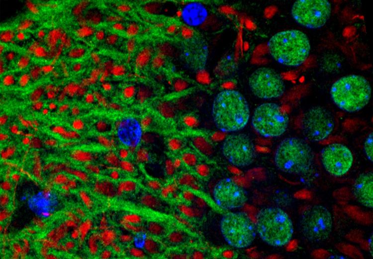 Ricerca indica l'attivazione di una proteina disregolata per trattare la perdita di memoria