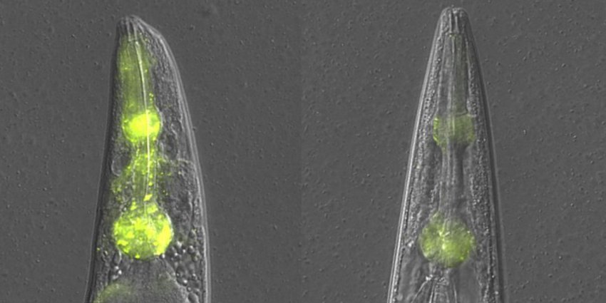 C elegans upper body with protioen aggregates