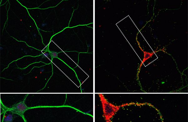 Cell body treated of BDNF