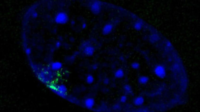 Cell nucleus with Barr Body 