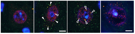 Svelato nuovo meccanismo di morte cellulare nelle neurodegenerazioni