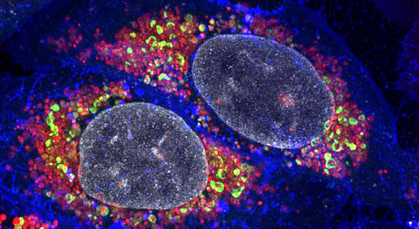 Cells full of damaged mitochondria