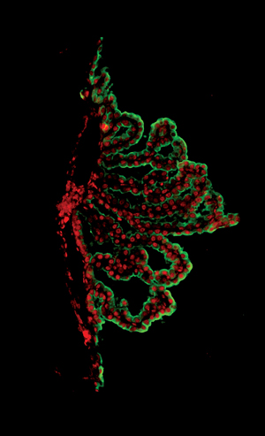 Identificata la firma dell'invecchiamento nel cervello