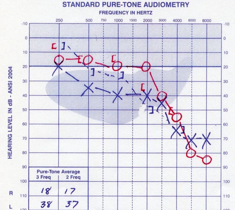 DanGibbs Audiogram