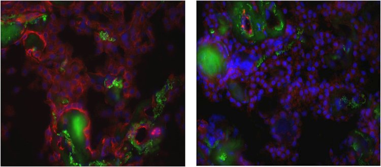 La barriera emato-encefalica non funziona nell'Alzheimer