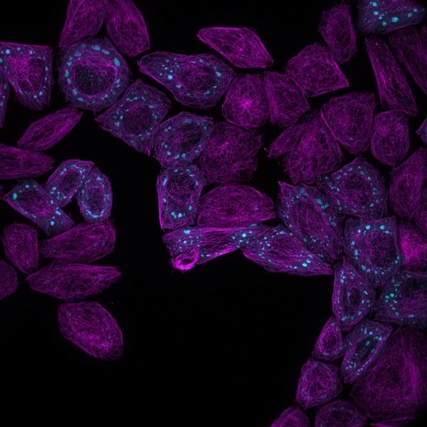 G3BP1 microtubules arsenite 002