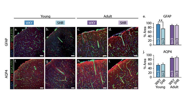 Healthy Blood Vessels Cognitive Decline