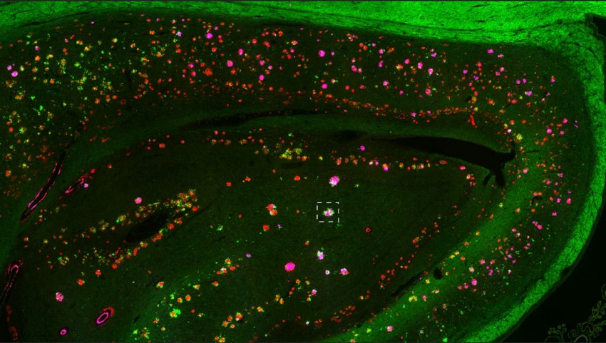 Human hippocampal brain section by Gael Barthet