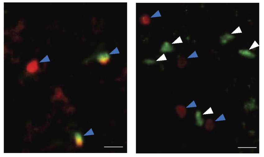 ILC2 immune cells white increased in old mice right compared with younger one left