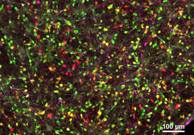 Infected neuronal culture Eimer et al NatNeurosci