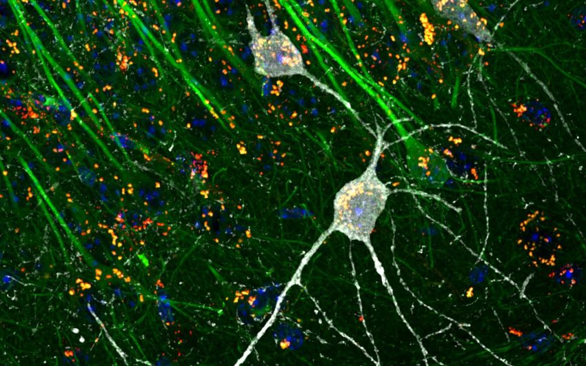 Interneuron undergoing autophagy in the hippocampus Rappe et al Embo