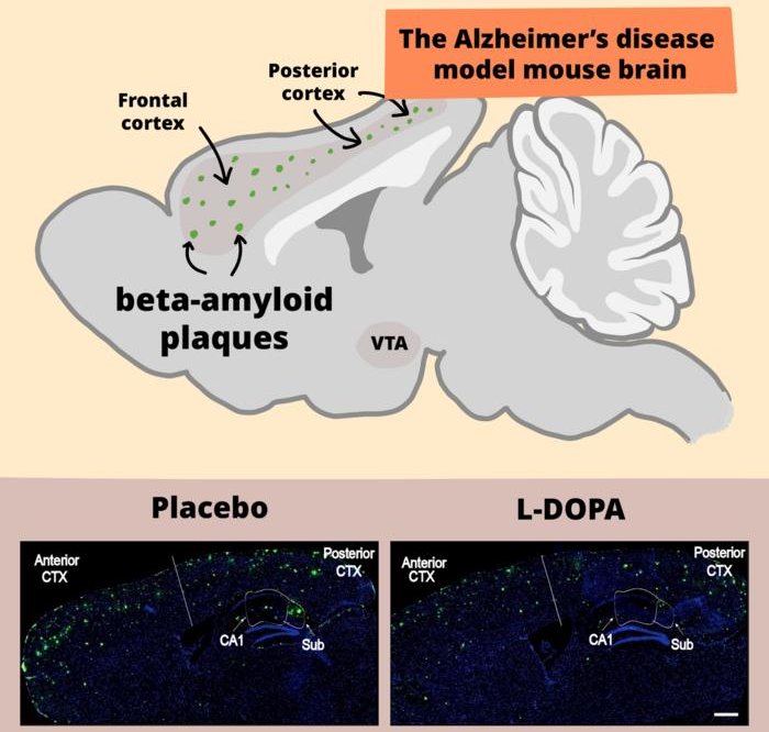 L dopa reduces beta amyloid Riken