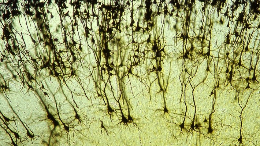 L5p neurons