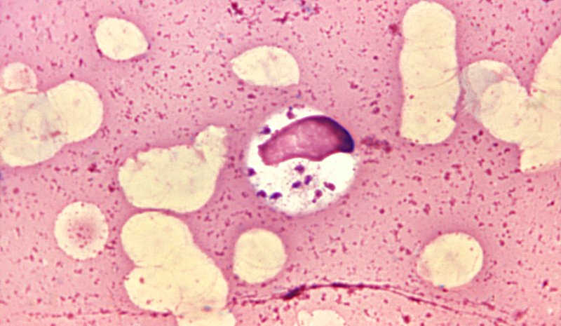 Leishmania donovani 01