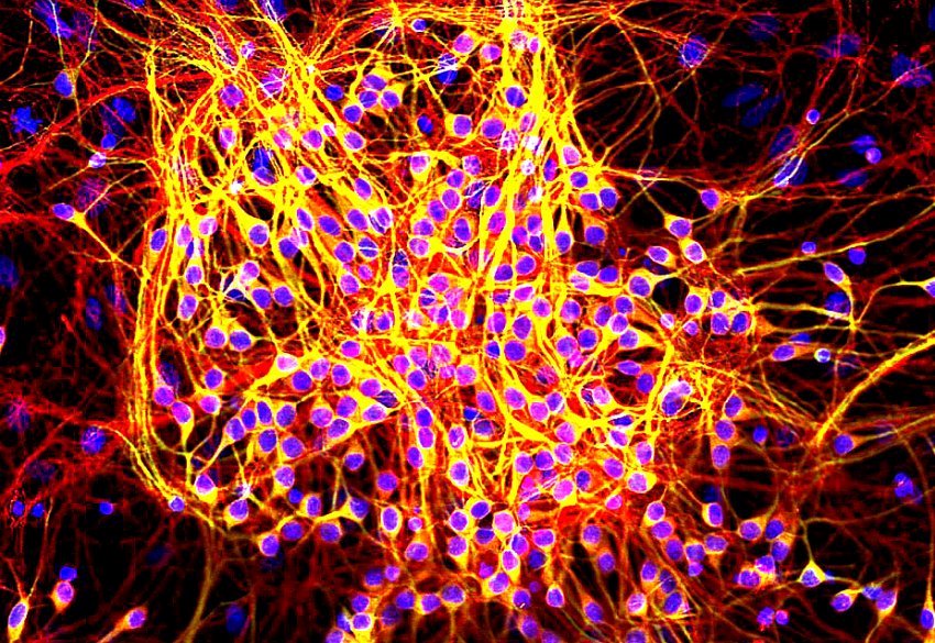 MAP2 tau in neurons Wikimedia Commons