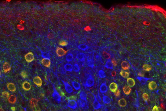 Come codifica il cervello tempo e luogo di un ricordo