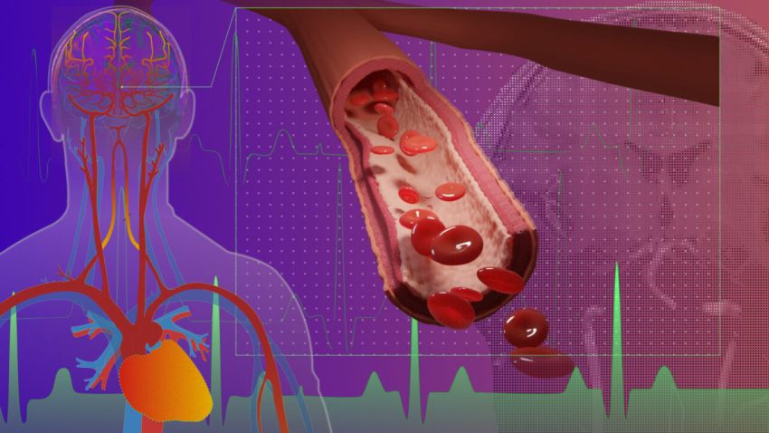 MRI for cerebral microvascular pulsatility