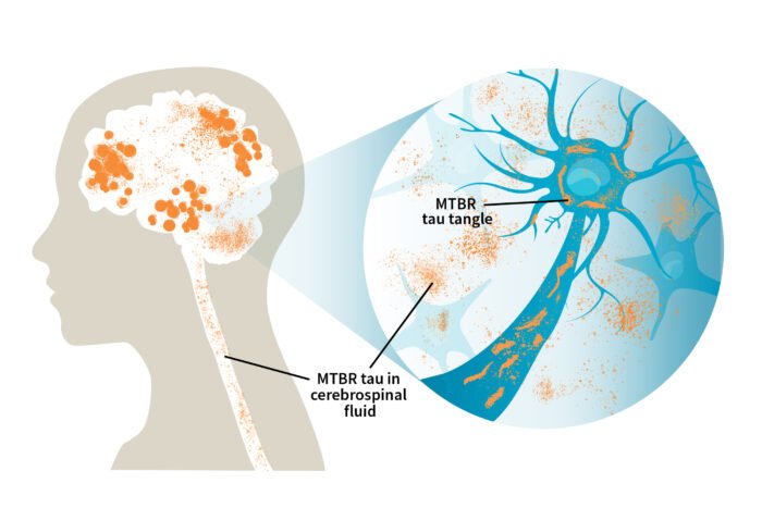 MTBR tau in cerebrospinal fluid