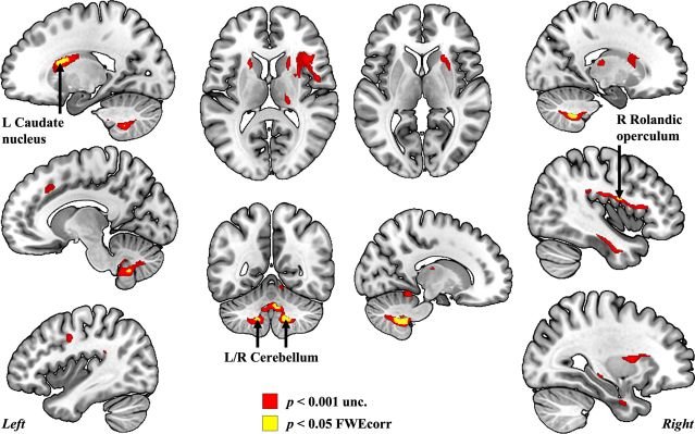 Marie et al. 2023 Neuroimage Reports