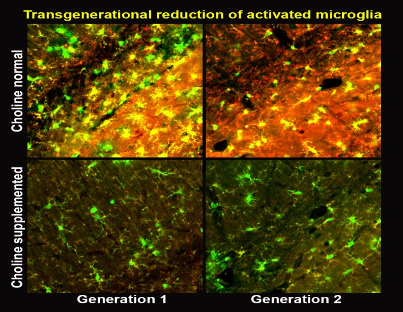 Microglia activation with normal and additional choline