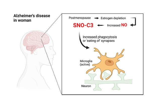 Microglia eating synapses in postmenopause
