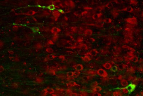 cco l'ennesimo farmaco che ferma l'Alzheimer ... nei topi