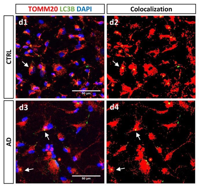Mitochondrial marker TOMM20 red autophagosome marker LC3B green and co localization mark of both after image processing yellow in astrocytes