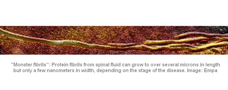 Monster fibrils Enpa