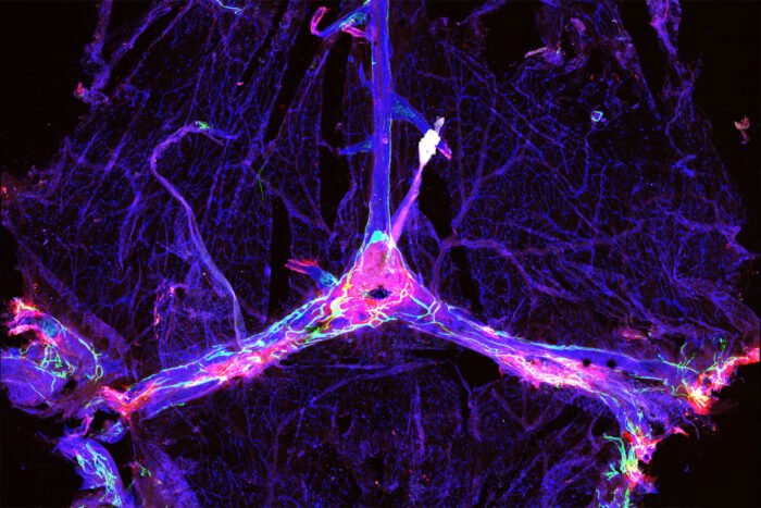 Mouse meningeal lymphatics