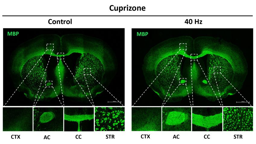 Myelination in mouse brain 