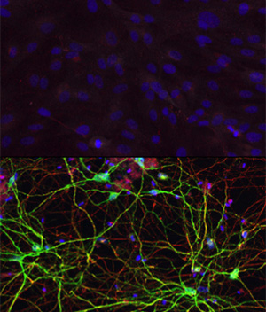 Cellule cutanee umane riprogrammate direttamente in cellule cerebrali